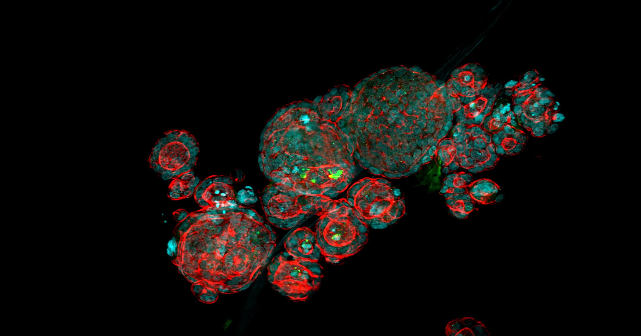 Organoids paving the way - Screening in Organoids